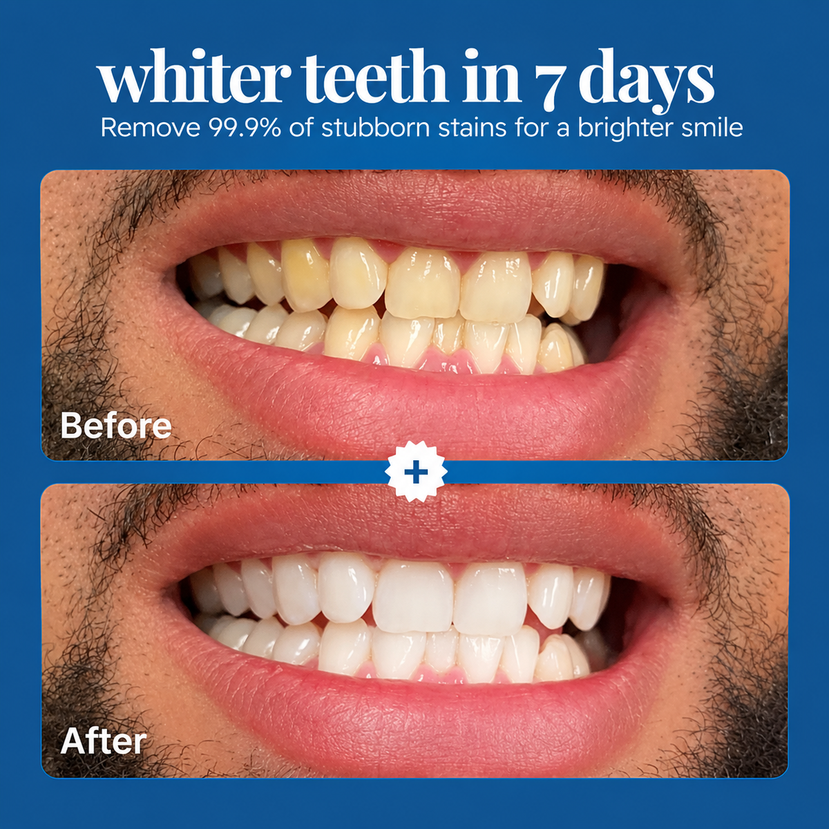 Teeth Whitening Powder
