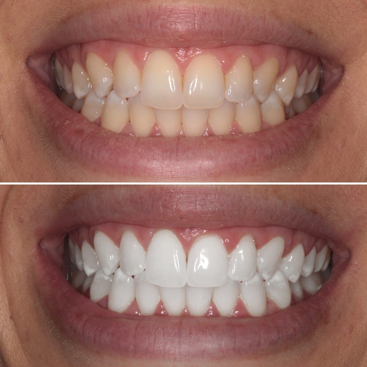 Teeth Whitening Powder