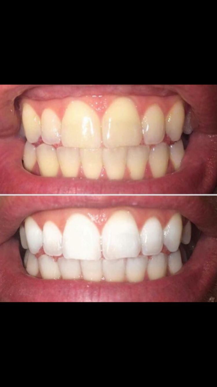 Teeth Whitening Powder